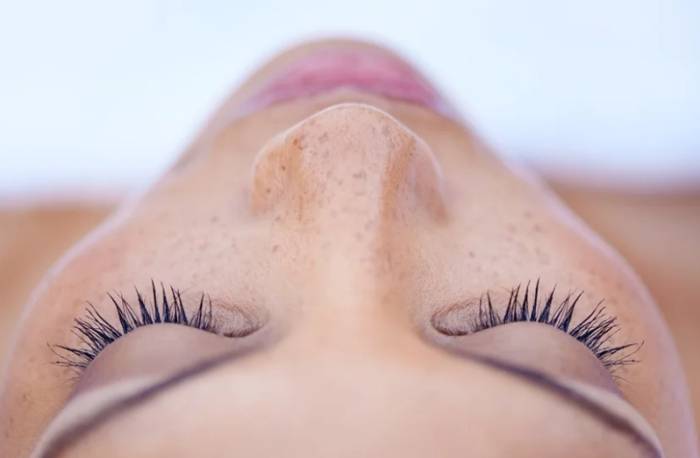 天然祛疤 天然祛疤