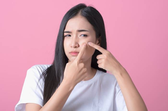 暗瘡發炎紅腫治療