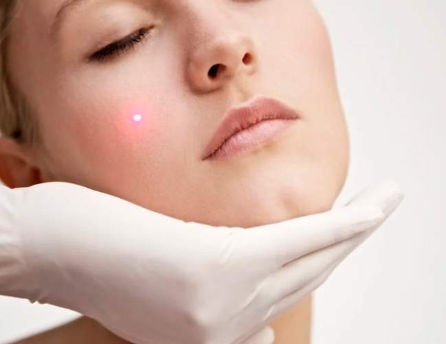 DIY皮肤护理 DIY皮肤护理