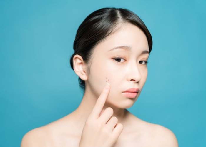 臉上長痘痘原因部位