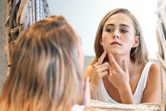 痘痘药膏推薦 痘痘药膏推薦