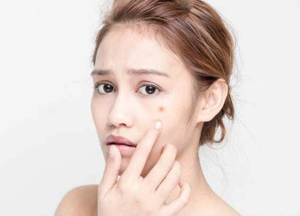 痘疤消除產品 痘疤消除產品