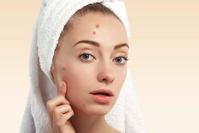 痘痘治疗 痘痘治疗