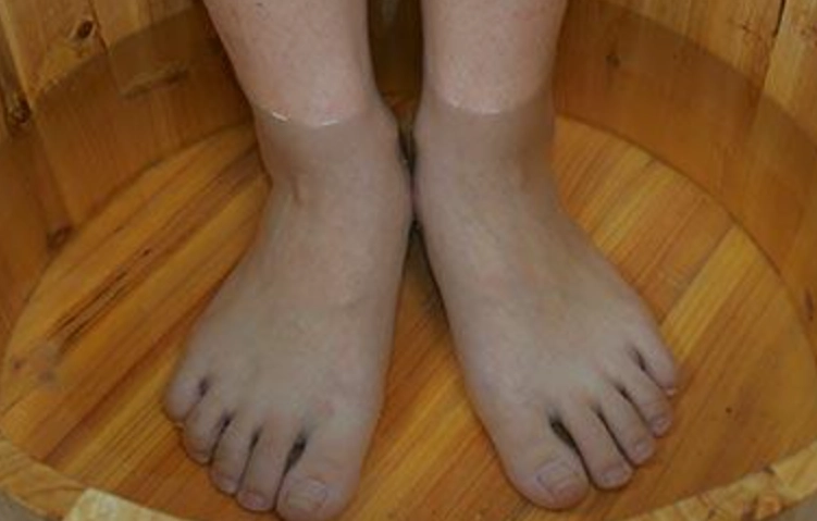 天然治香港腳方法 天然治香港腳方法
