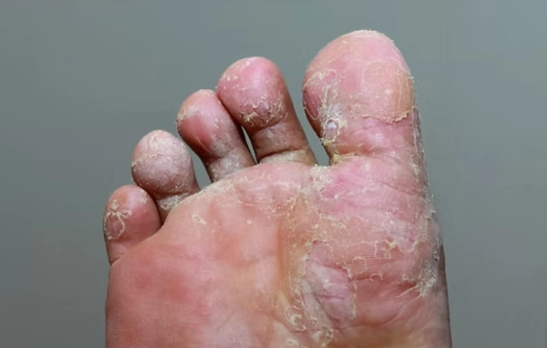 小蘇打粉用法 小蘇打粉用法