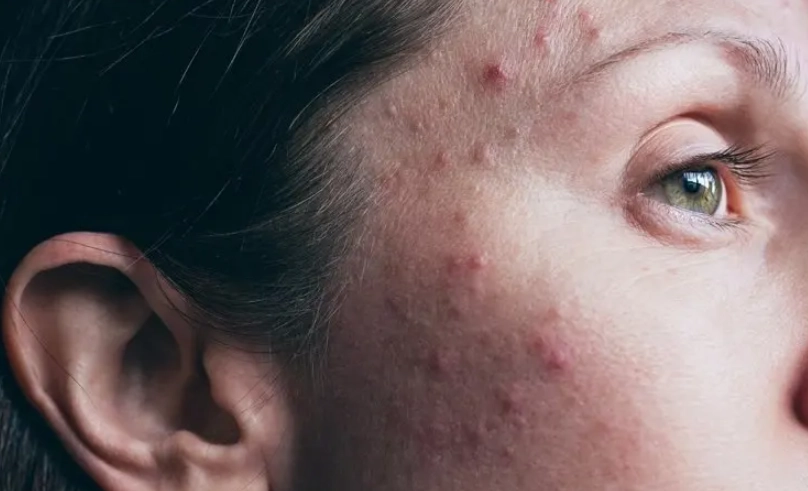 積雪草功效 積雪草功效